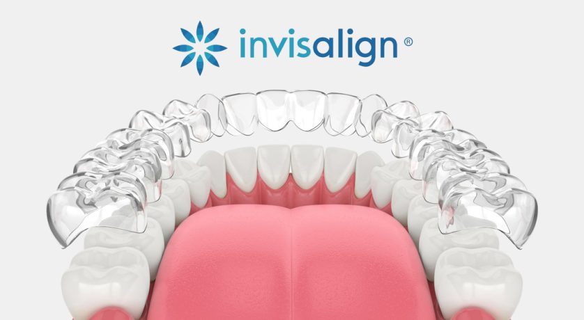 Invisalign in Bridge City, TX, Invisalign near me